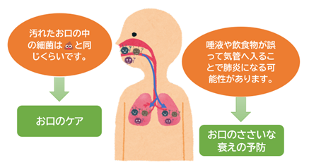 誤嚥性肺炎イメージイラスト